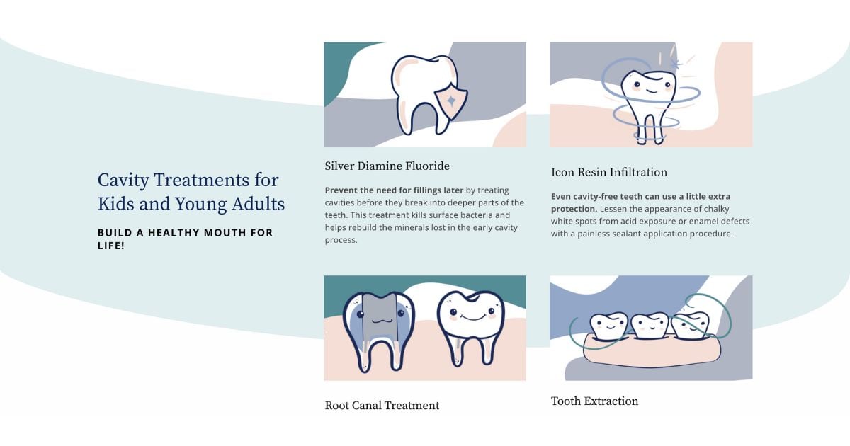 An educational segment from the preventative dentistry page of Bass's website, titled 'Cavity Treatments for Kids and Young Adults', with a soothing pastel background. It features four illustrated icons with brief descriptions: 'What Causes Cavities', explaining the process of cavity formation; 'Signs & Symptoms', highlighting how to recognize a cavity; 'Best Care Treatment', outlining effective treatment options; and 'Tooth Sensitivity', providing insights on managing and preventing sensitivity.